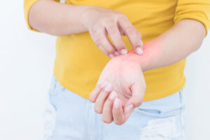 Haut mit atopischem Ekzem pflegen. Was hilft, atopische Dermatitis zu heilen?