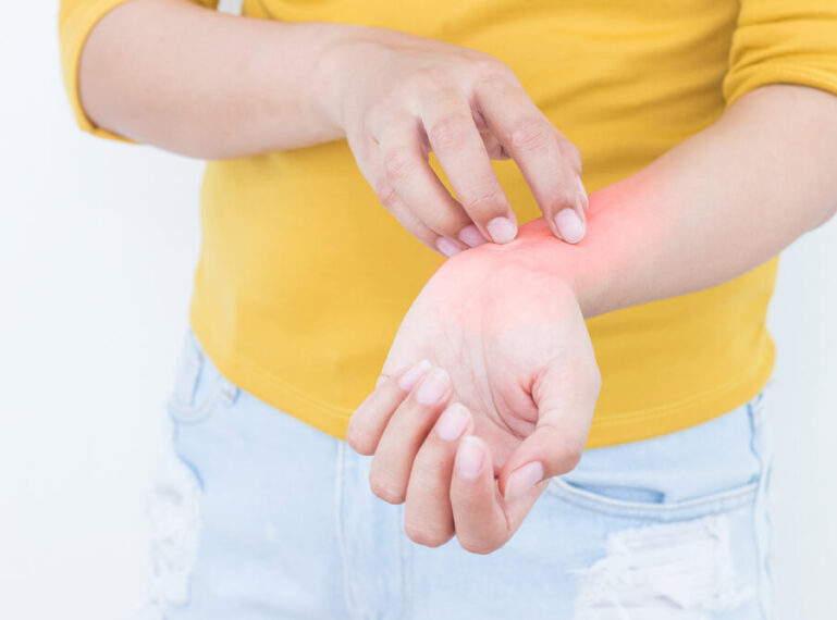 Haut mit atopischem Ekzem pflegen. Was hilft, atopische Dermatitis zu heilen?